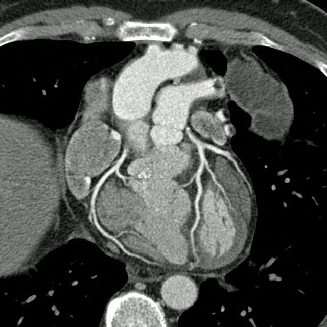 Cardiology Negative Scan